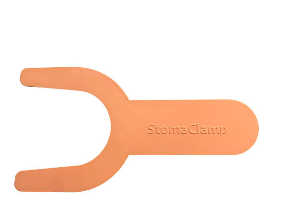 StomaClamp ein patentiertes Produkt von einer Person mit einem Stoma