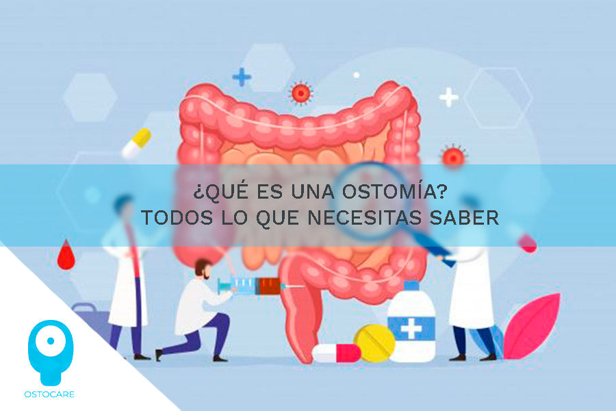 Was ist ein Stoma? Alles, was Sie wissen müssen