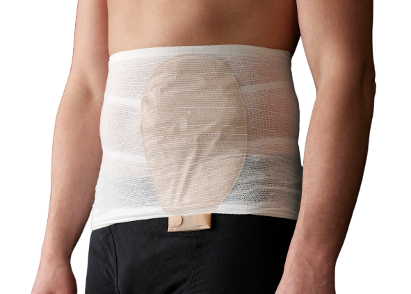 Ostomy Belt Corsinel  StomaSafe Classic