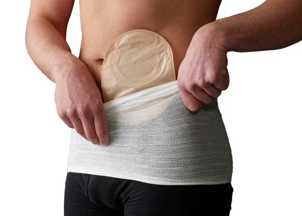 Cintura Di Supporto Per Ernia Per Stomia, Fascia Addominale Traspirante Regolabile, Fascia Per Ernia Per Stomia, Cintura Per Ernia Per Stomia Cintura Per Ernia Per Stomia Stomaco Truss Binder Cintura Di Supporto Per Ernia Per Stomia, Fascia Addominale Traspirante Regolabile, Fascia Per Ernia Per Stomia, Cintura Per Ernia Per Stomia Cintura Per Ernia Per Stomia Stomaco Truss Binder